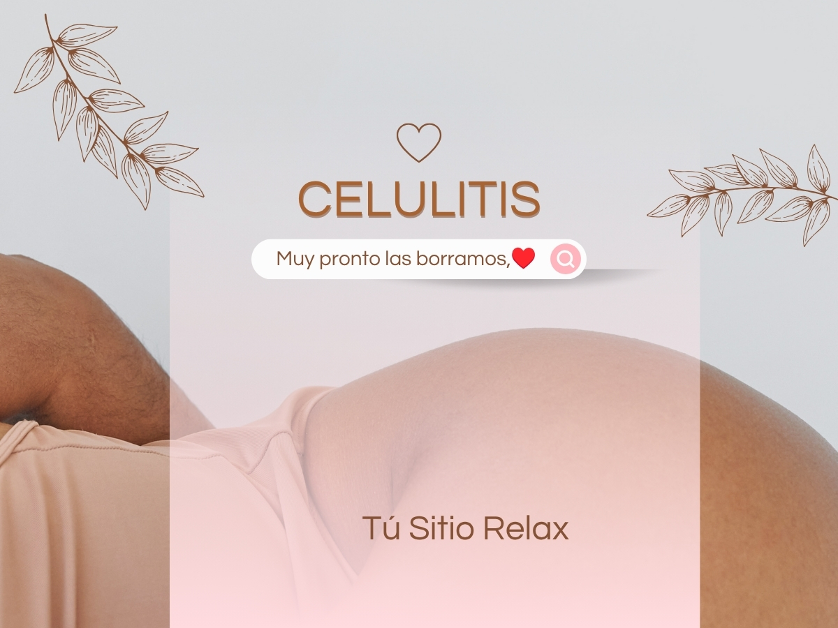Tratamientos Anticelulitis